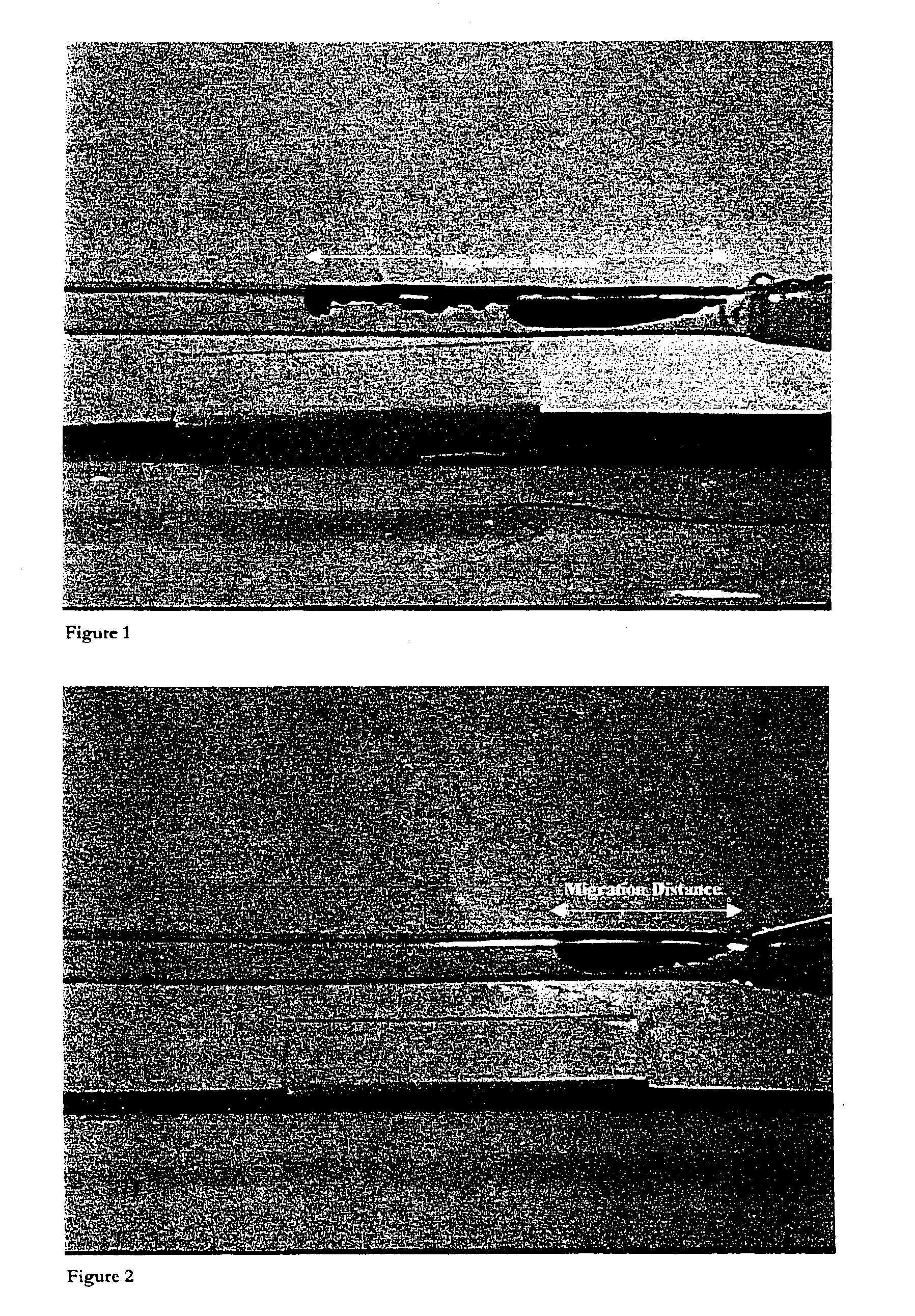 High viscosity embolizing compositions