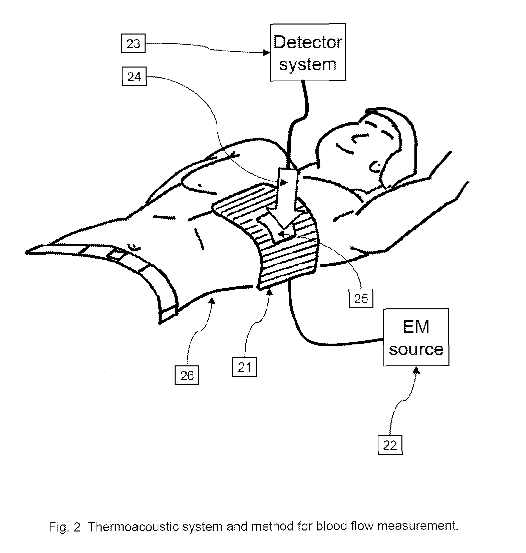 Thermoacoustic system for analyzing tissue