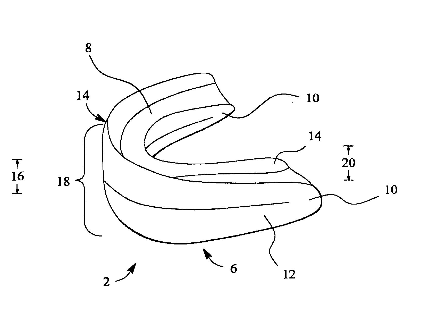 Dental appliance having an altered vertical thickness between an upper shell and a lower shell with an integrated hinging mechanism to attach an upper shell and a lower shell and a system and a method for treating malocclusions