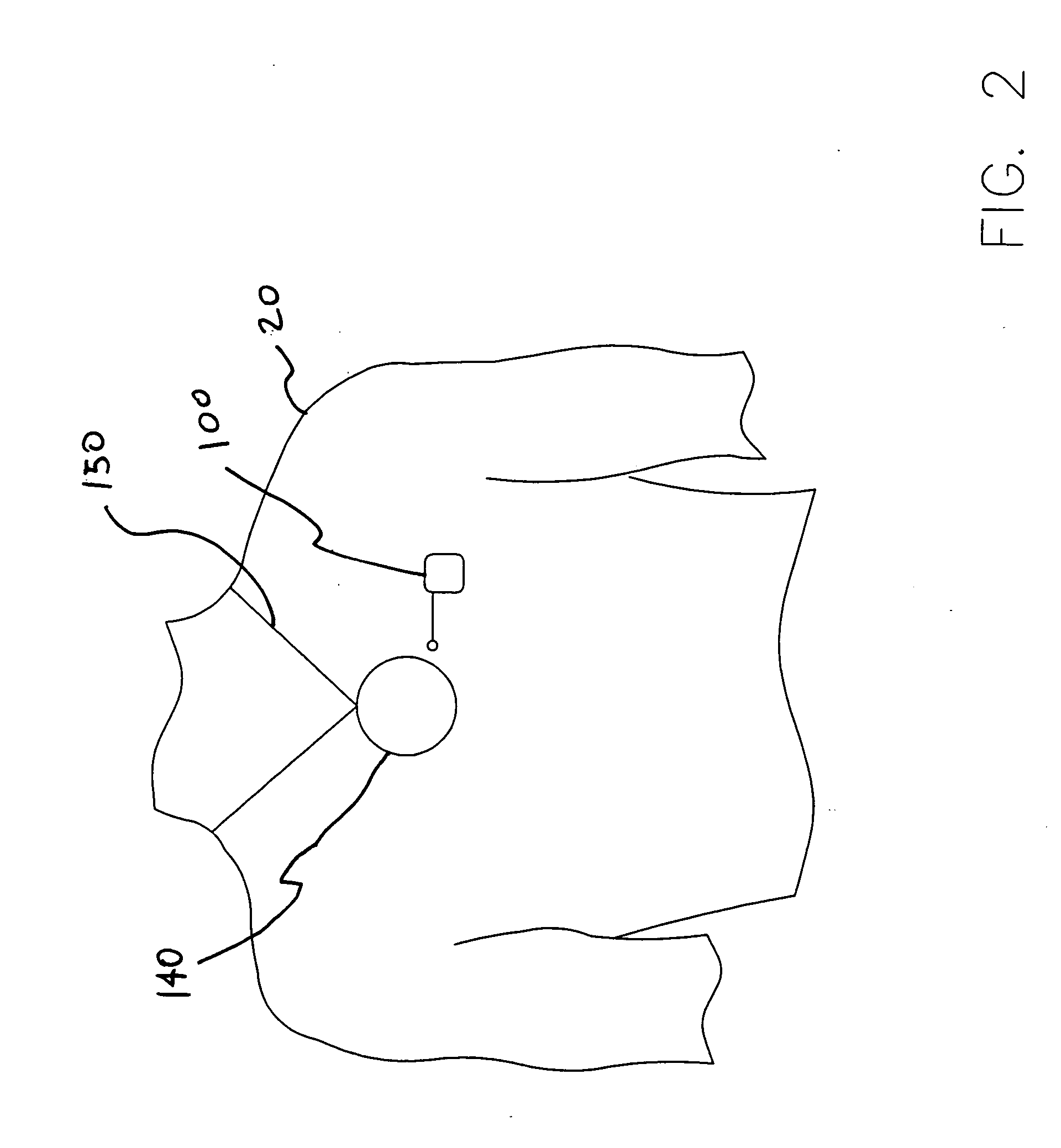 Implantable medical devices and related methods