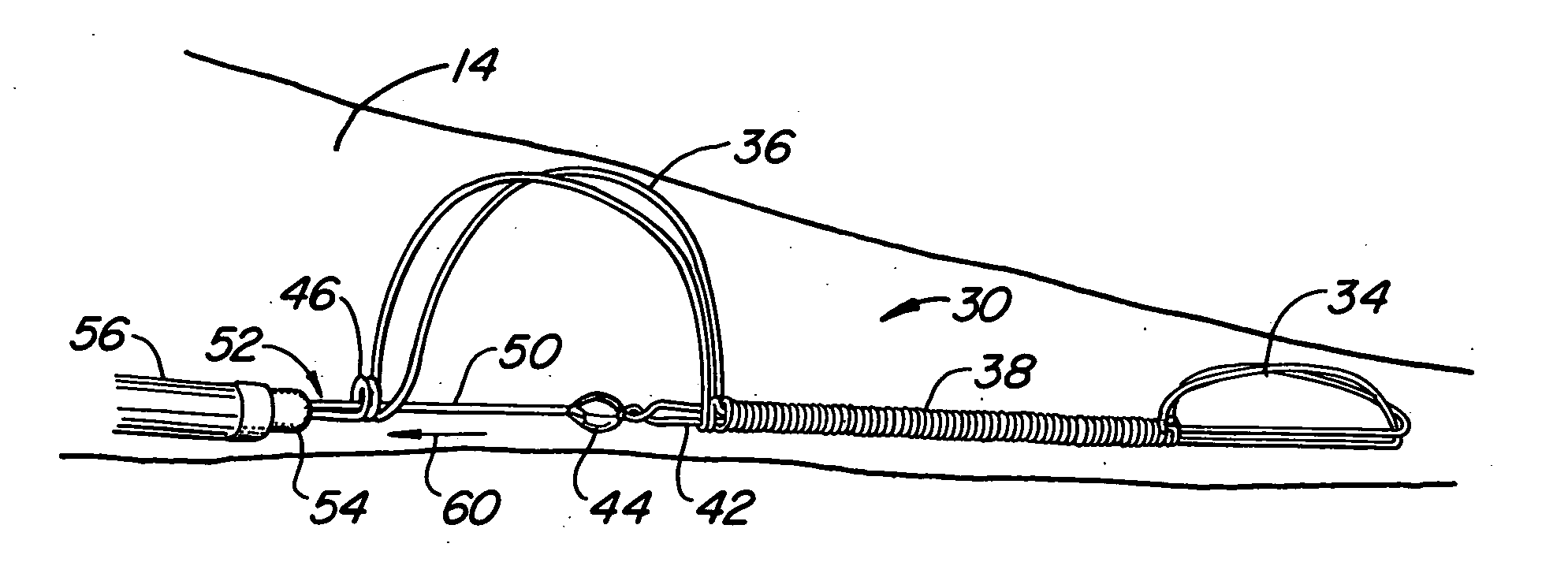 Device, system and method to affect the mitral valve annulus of a heart