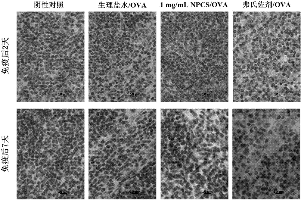 Quaternary phosphonium chitosan and application of quaternary phosphonium chitosan serving as vaccine immune adjuvant