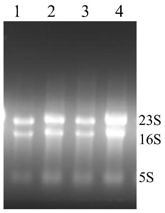 A rapid detection kit and detection method for mycobacterium tuberculosis nasba-elisa in deer