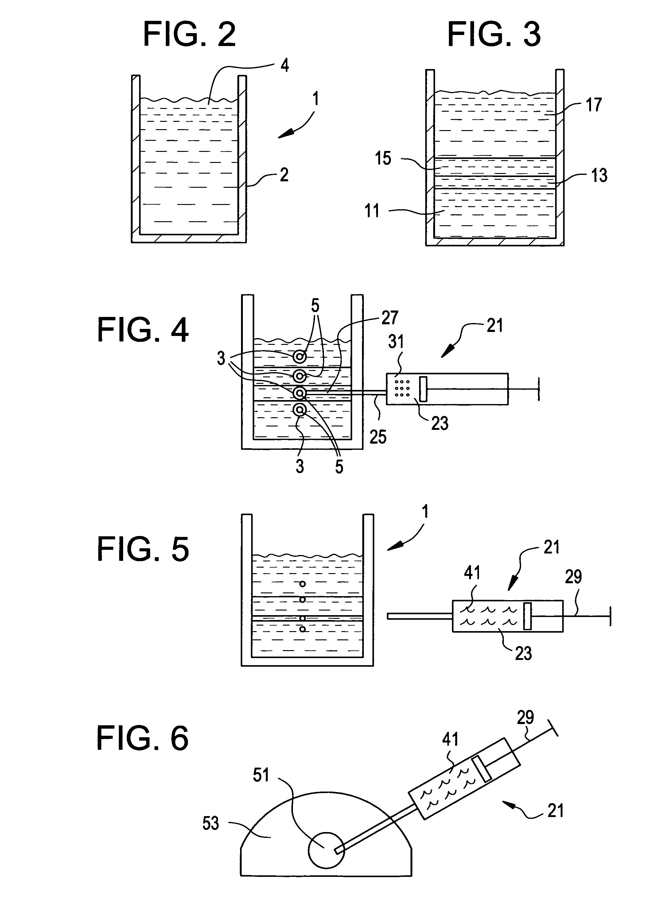 Intradiscal injection of autologous interferon