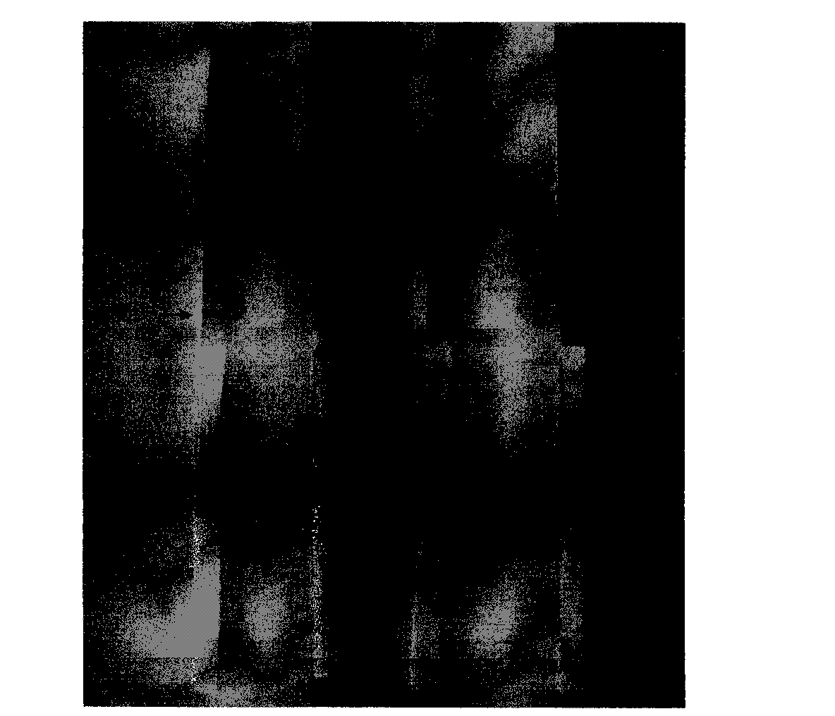 Application of Survivin antibody and esophageal cancer immunochromatography detecting test strip prepared therewith