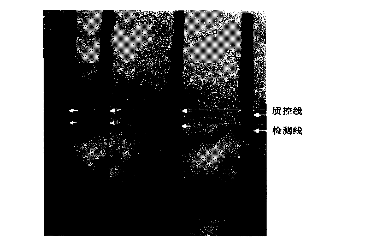 Application of Survivin antibody and esophageal cancer immunochromatography detecting test strip prepared therewith