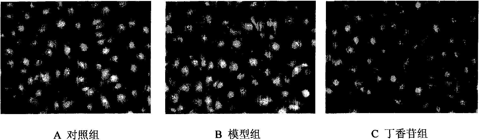 Application of syringin in preparation of medicine for treating acute gout