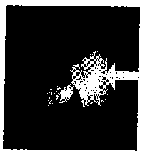 Method and Device For Representing the Microstructure of the Lungs