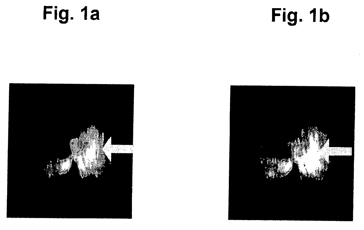 Method and Device For Representing the Microstructure of the Lungs