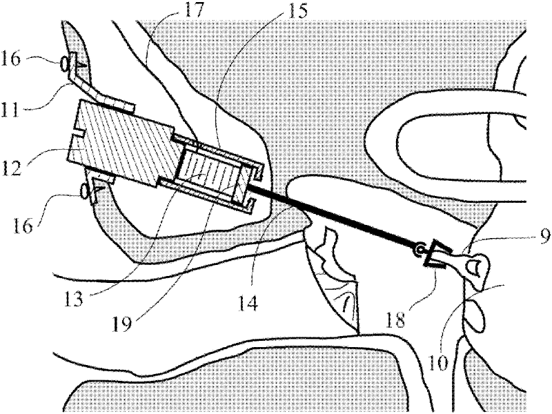 Actuator for hearing compensation and hearing aid device with the same