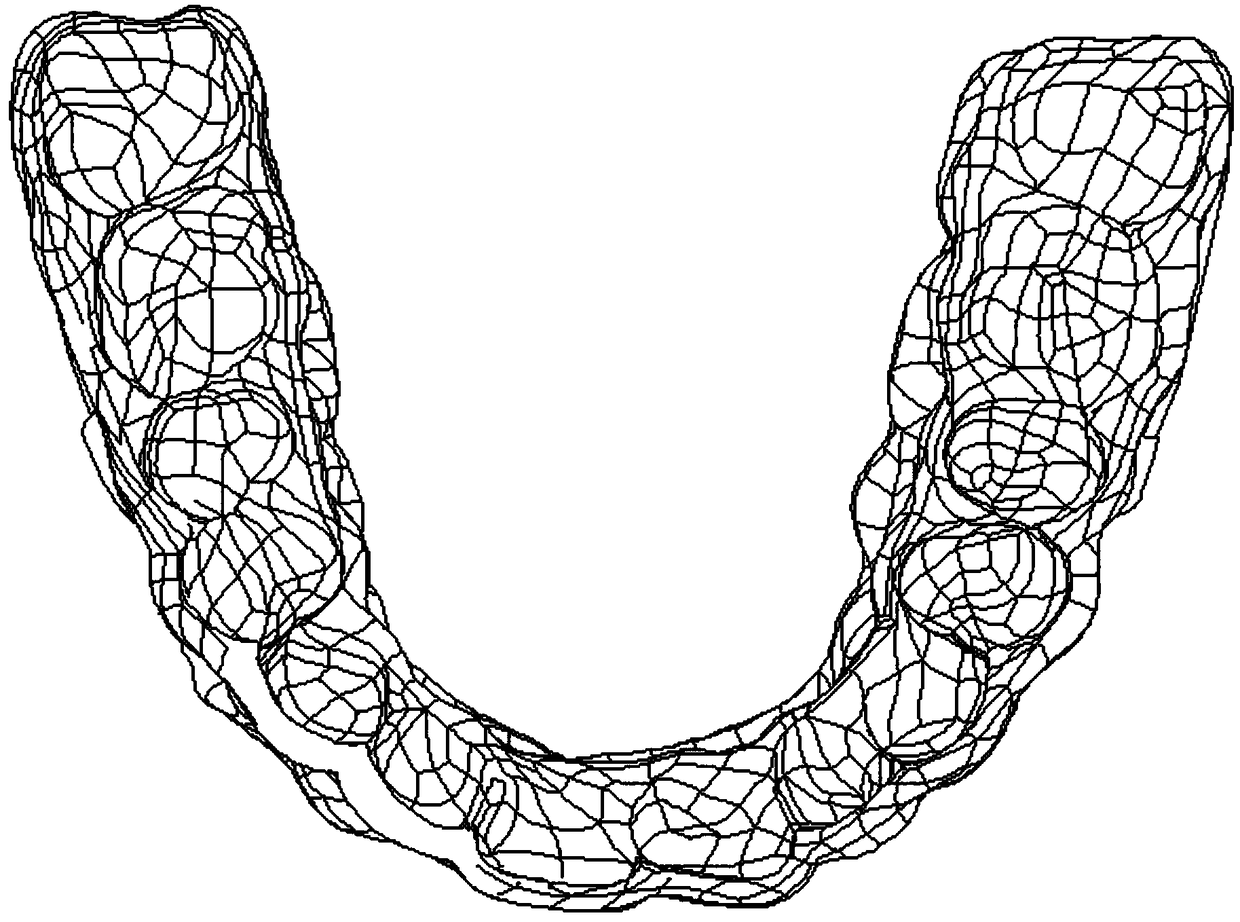 Customised intraoral snore-ceasing equipment