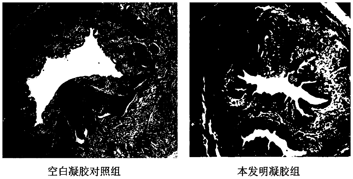 Temperature-sensitive gel for promoting vagina tightness and preparation method and application thereof