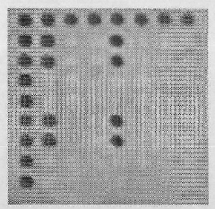 Biologic chip image wavelet de-noising method based on Bayesian estimation