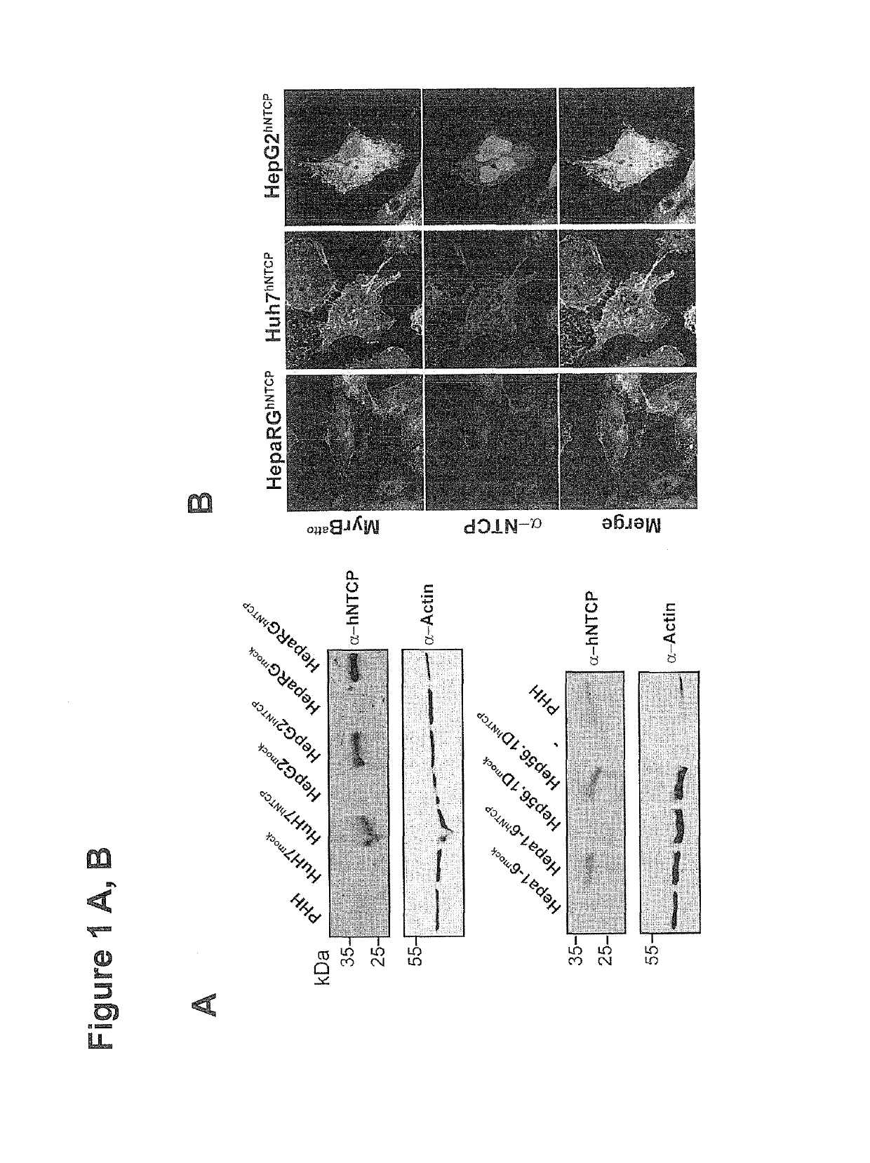 Lipopeptides for use in treating liver diseases and cardiovascular diseases