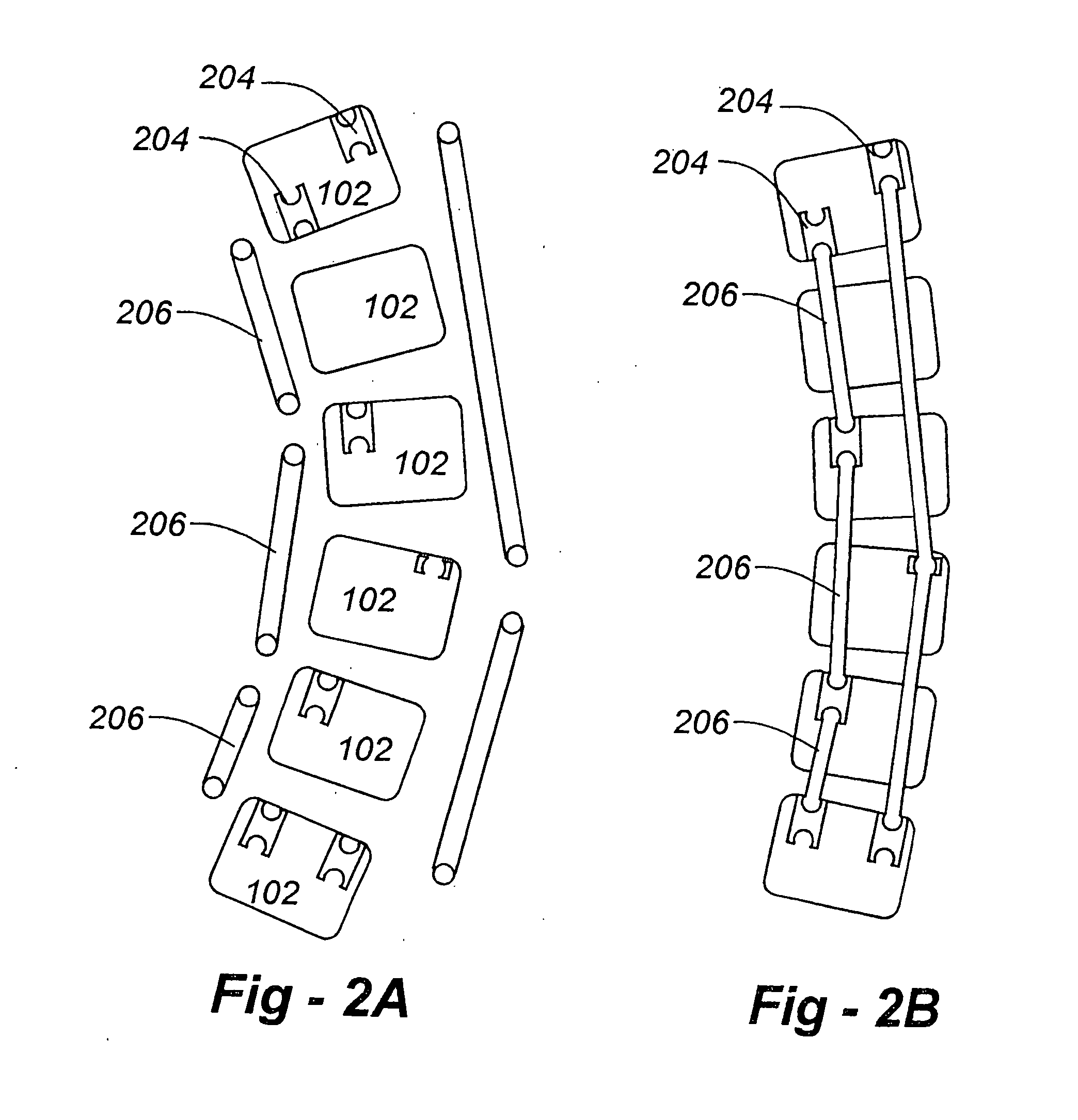 Spinal alignment system and related methods