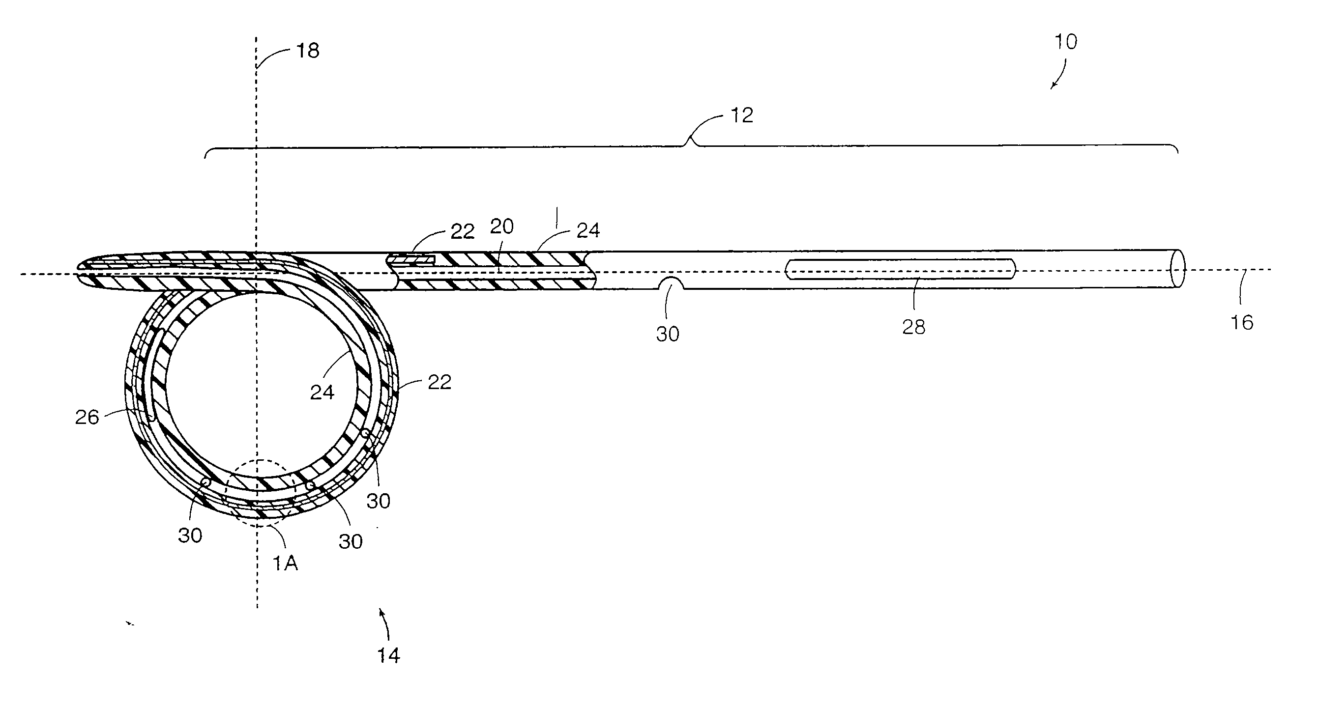 Reinforced Retention Structures