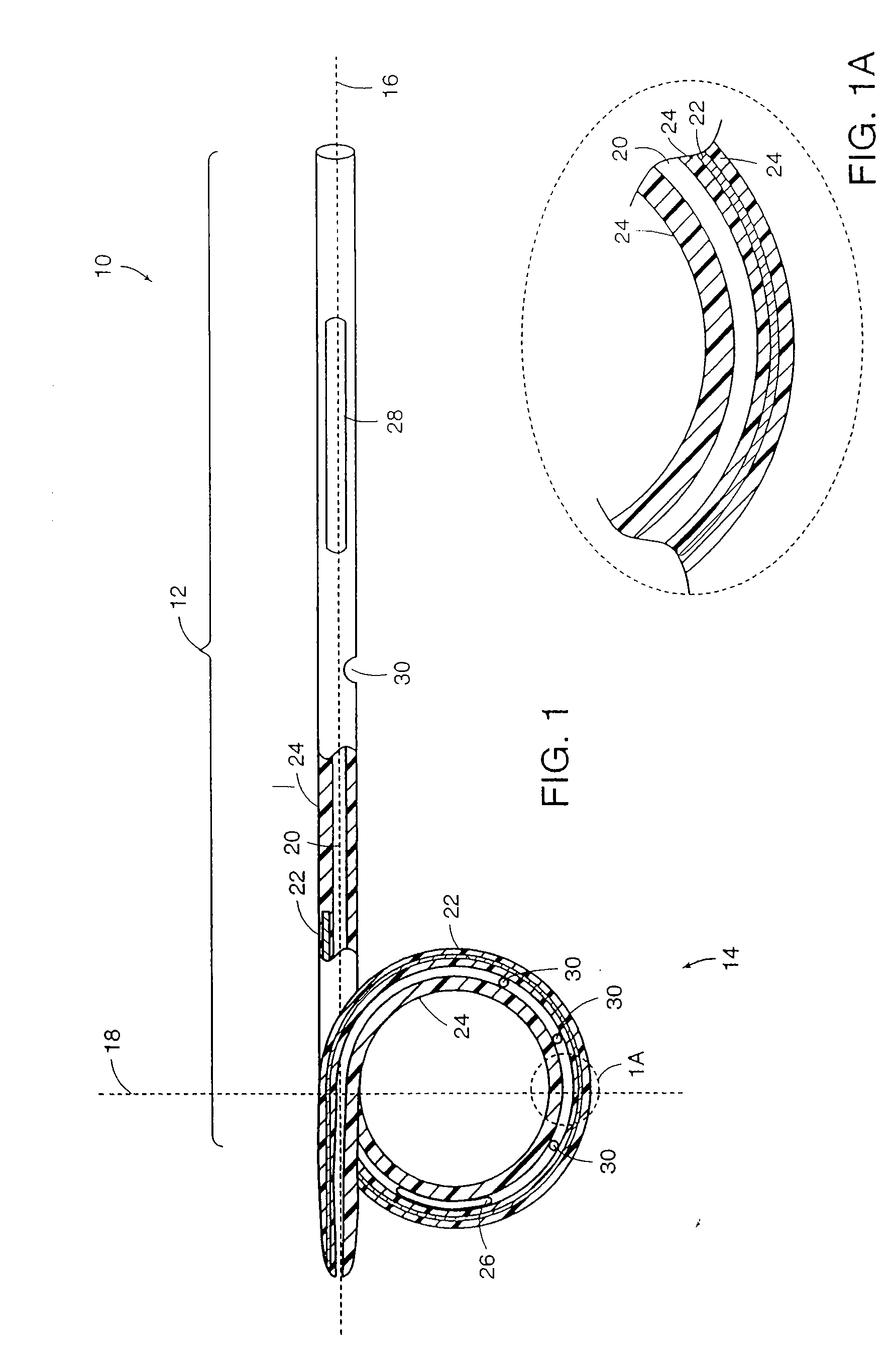 Reinforced Retention Structures