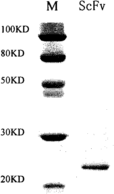 Antibody targeted complement inhibitor with anti-inflammatory action