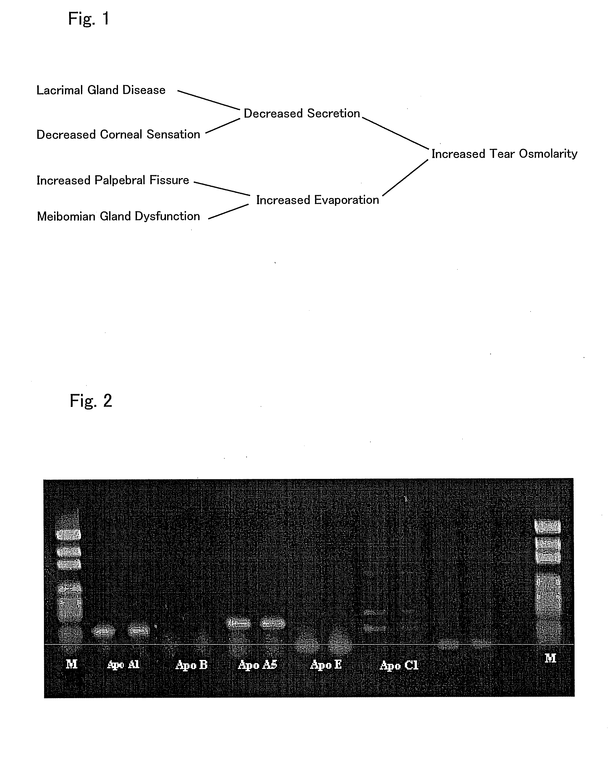 Ophthalmic composition