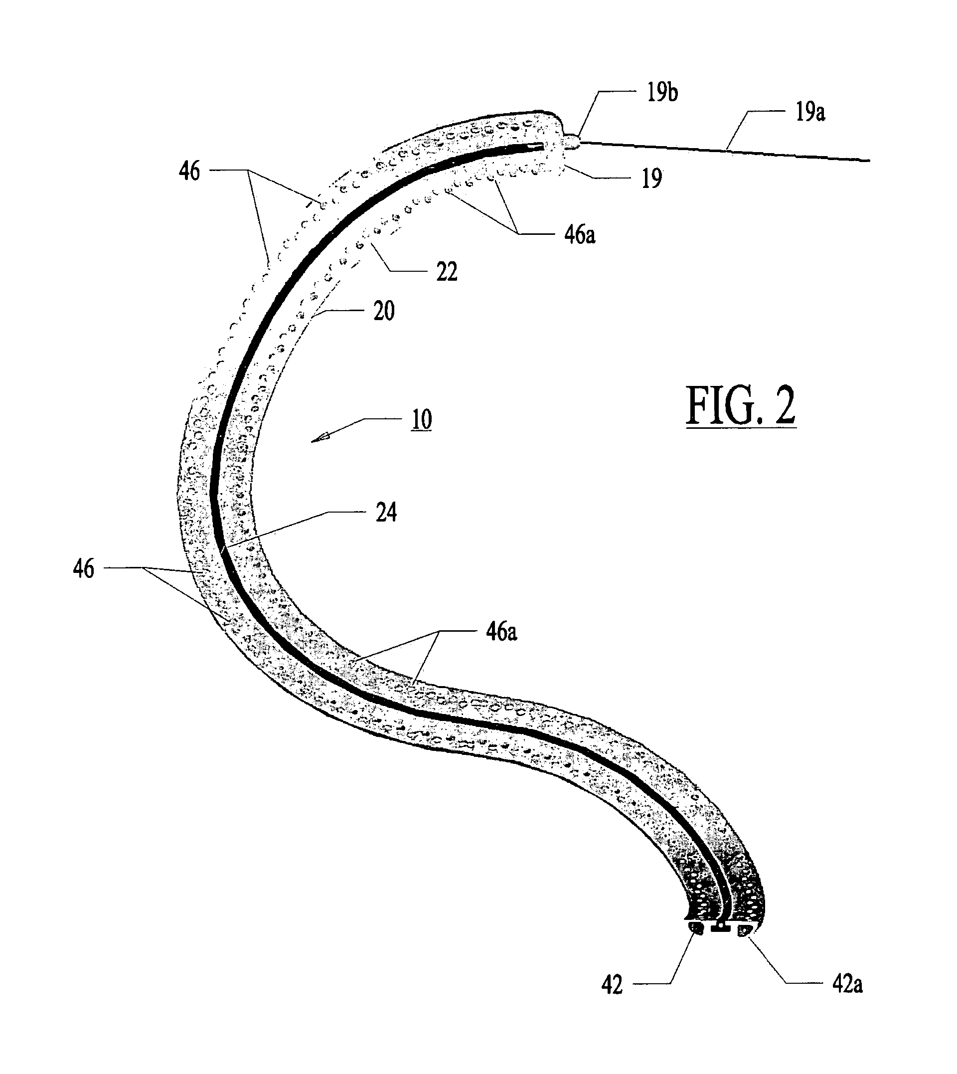 Apparatus and method for guided ablation treatment