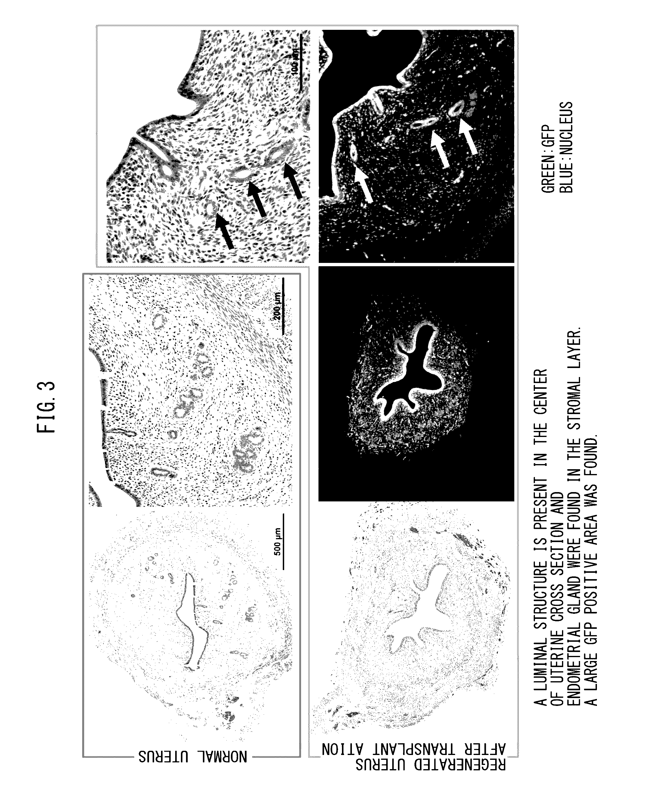 Cell composition for treatment of uterine tissue and method for producing same