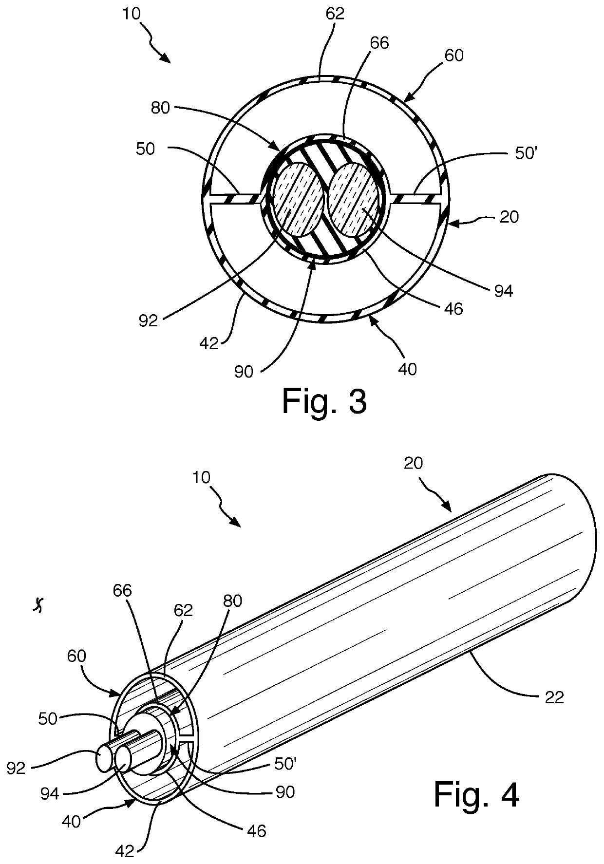 Catheter for thromboembolic disease with mechanic waves, injection and ejection