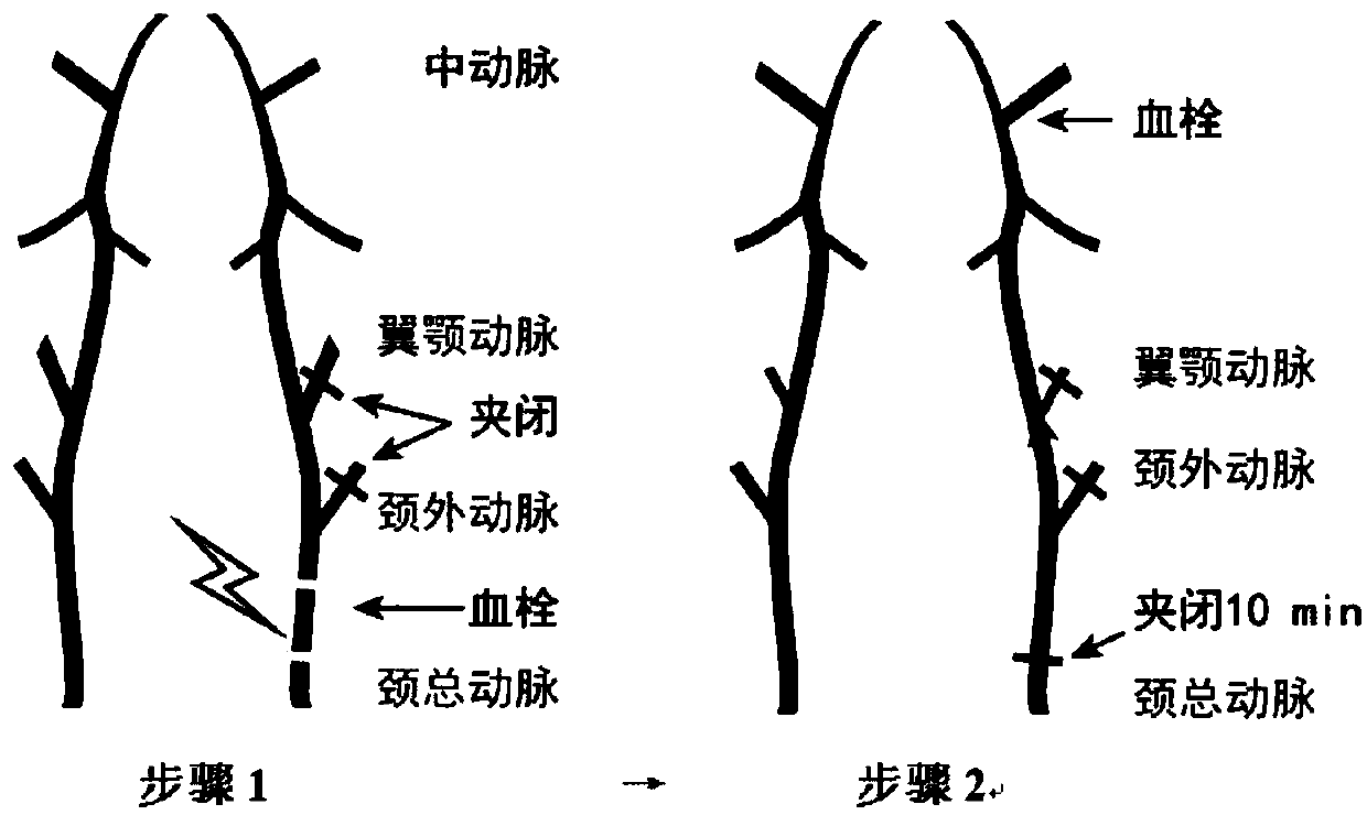 Preparation method for mouse thrombotic stroke model