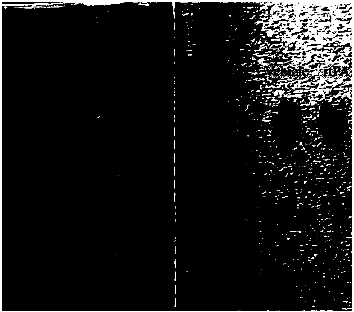 Preparation method for mouse thrombotic stroke model