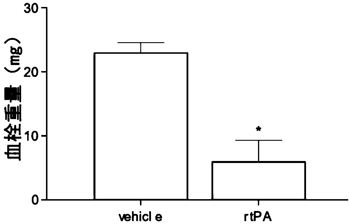 Preparation method for mouse thrombotic stroke model