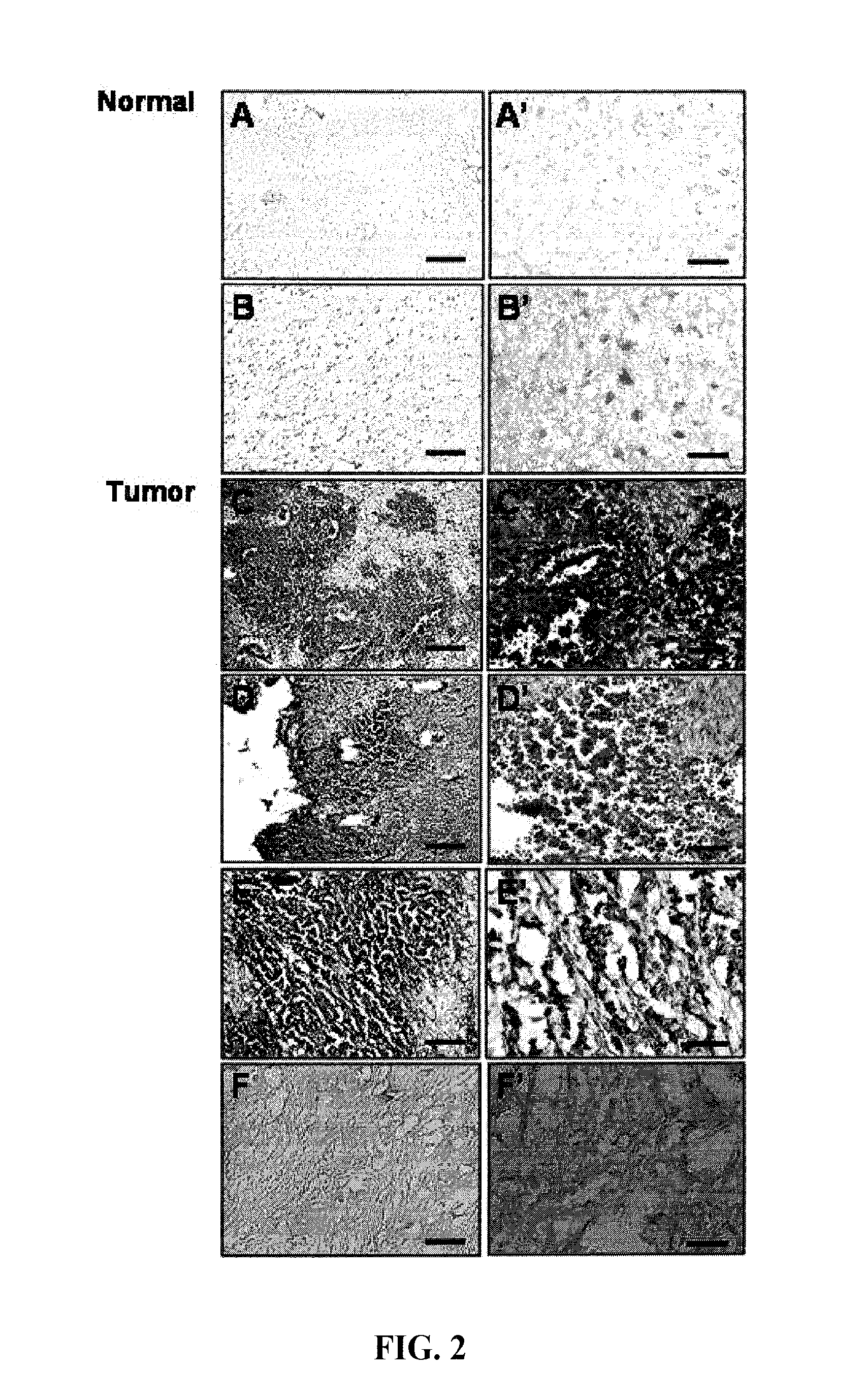 Composition for inducing migration of neural stem cells containing periostin as effective ingredient