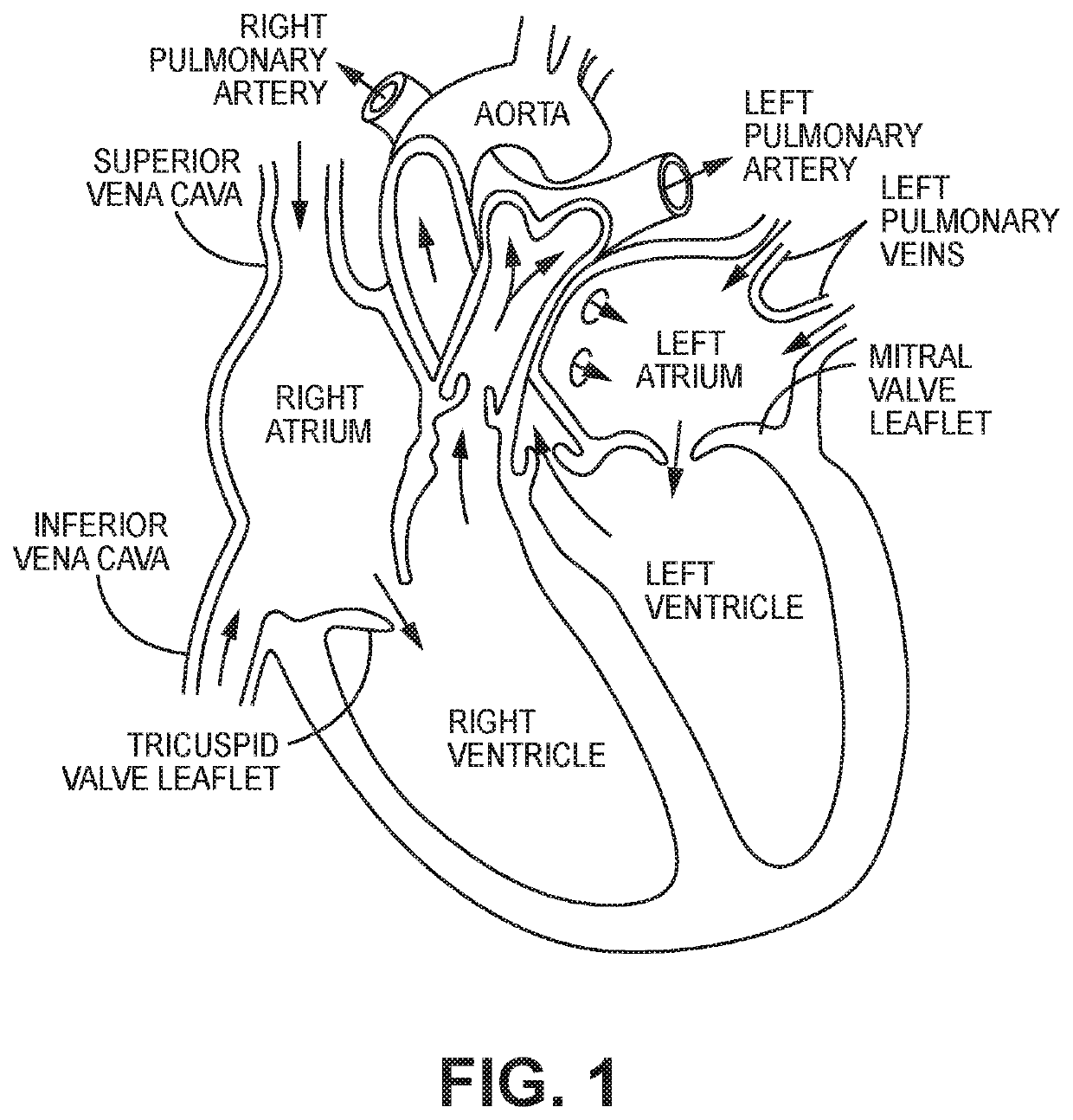 Hydrophilic skirt for paravalvular leak mitigation and fit and apposition optimization for prosthetic heart valve implants