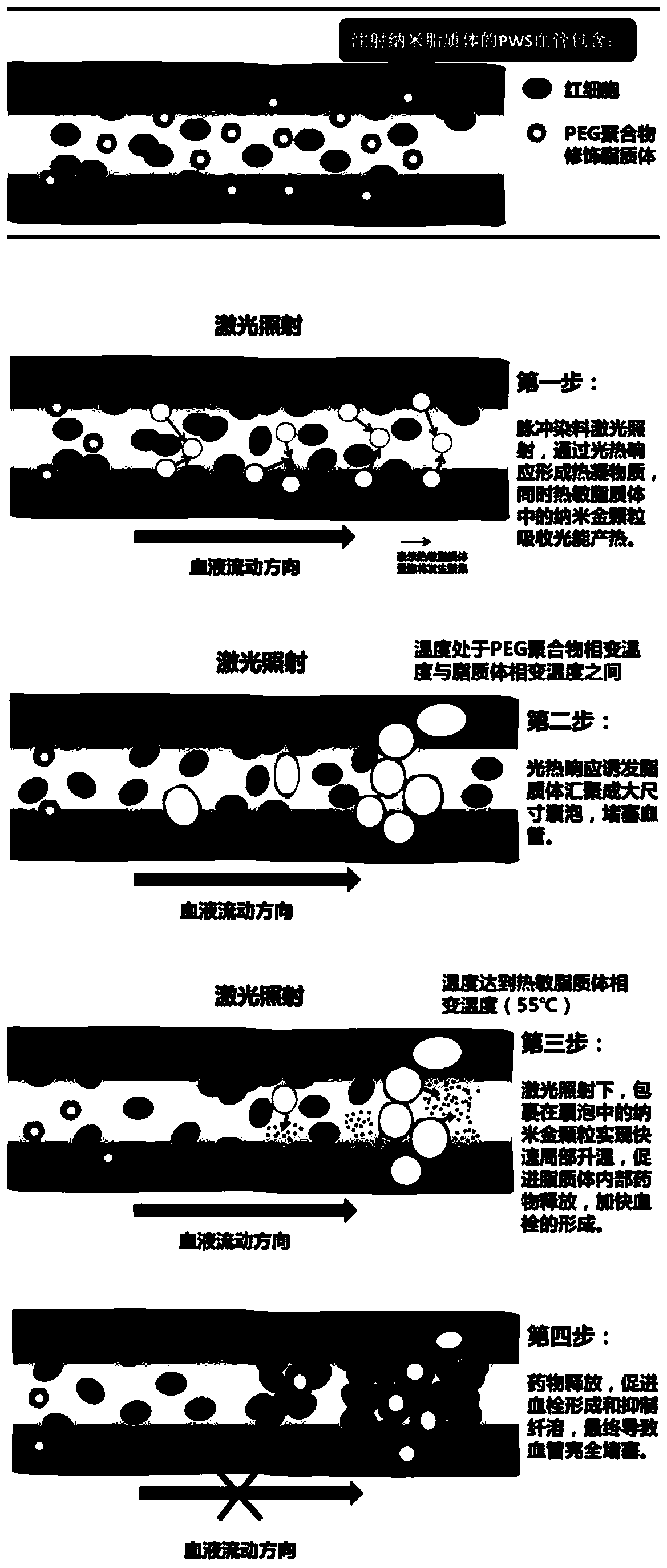 Nano-gold photothermal effect targeted drug delivery complex lipidosome based on polymer modification, implementation method of lipidosome and application of lipidosome