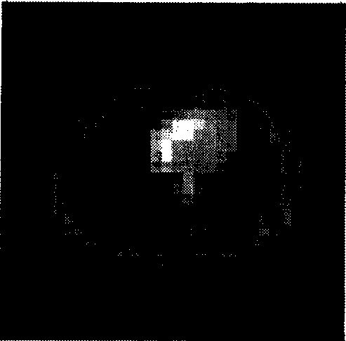 Kalman filtering image reconstruction method in PET imaging