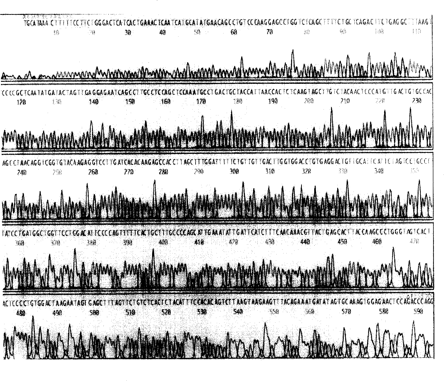 Recombinant plasmid containing effective B cell activation factor gene promotor and its preparation method and uses