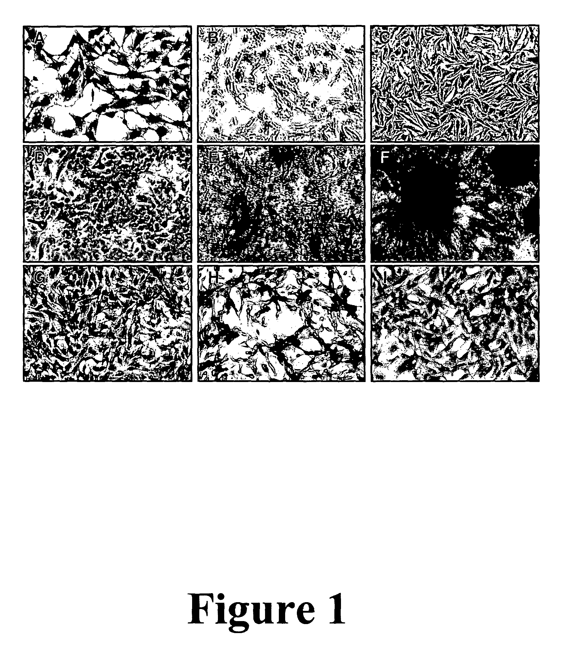 Polypeptides for increasing mutant CFTR channel activity