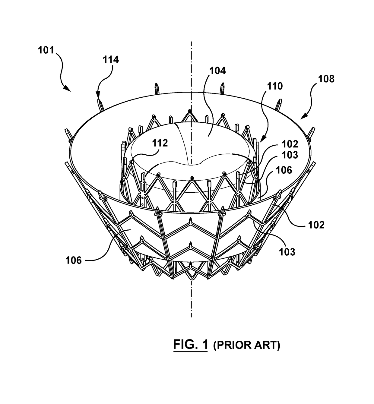 Chordae tendineae management devices for use with a valve prosthesis delivery system and methods of use thereof