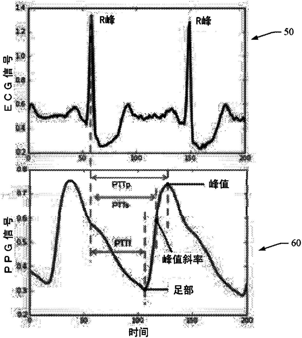 Method to quantify photoplethysmogram (PPG) signal quality