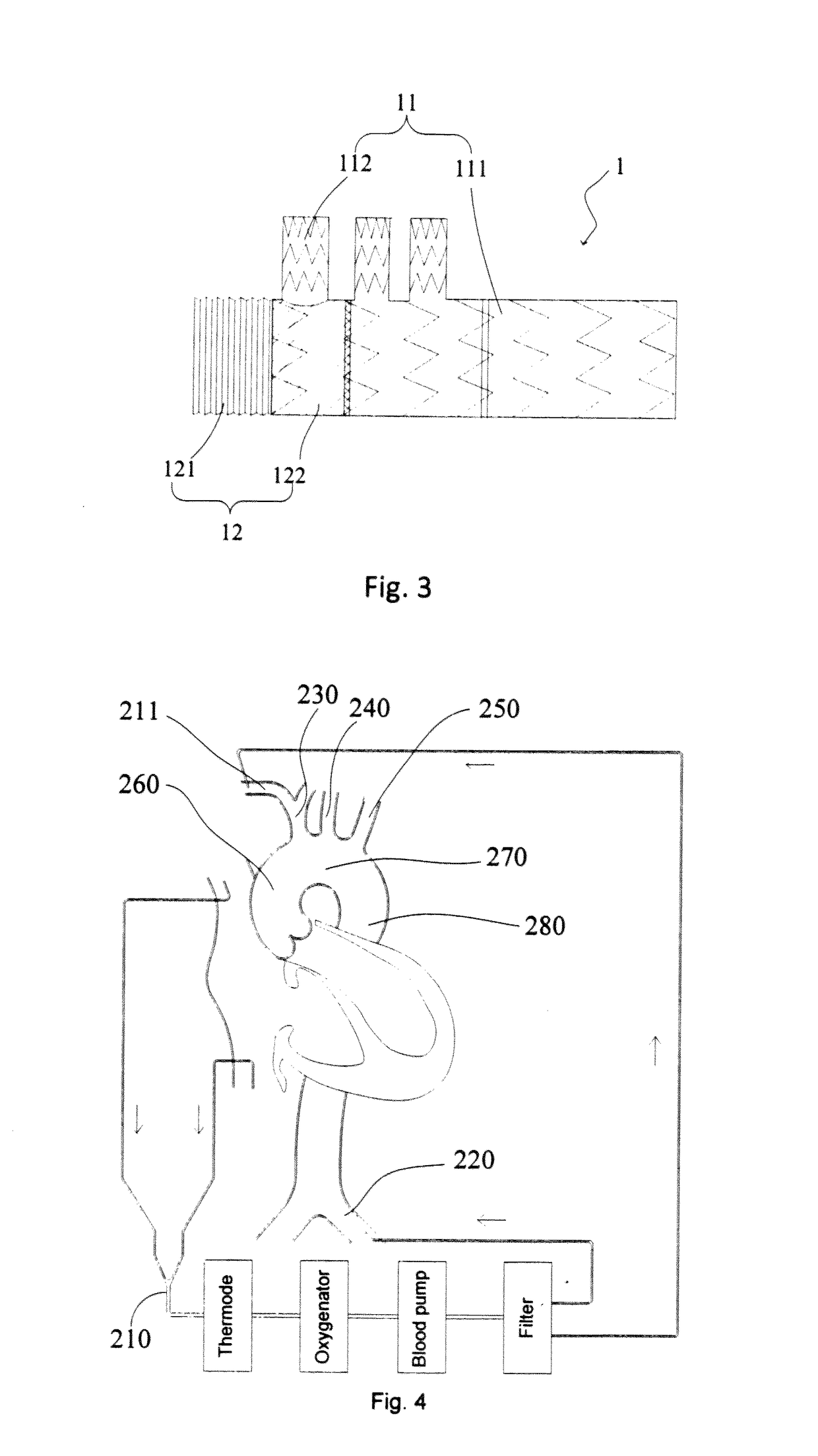 Method for Treating Aortic Arch Diseases