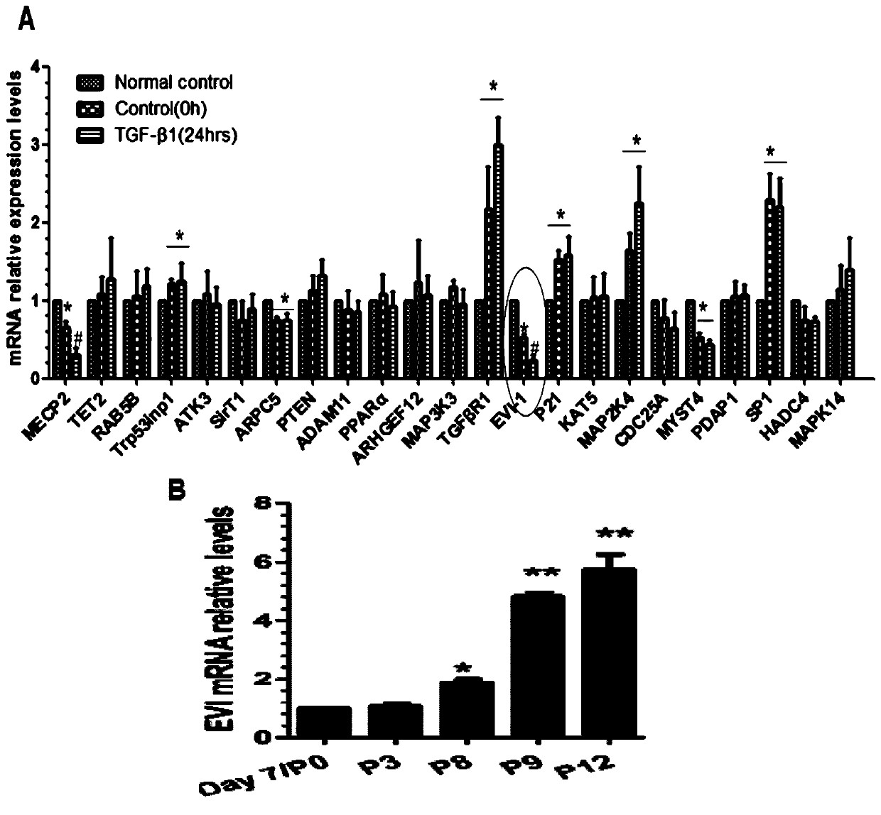 Application of evi-1 inhibitor in preparation of medicine for treating abnormal vascular remodeling disease