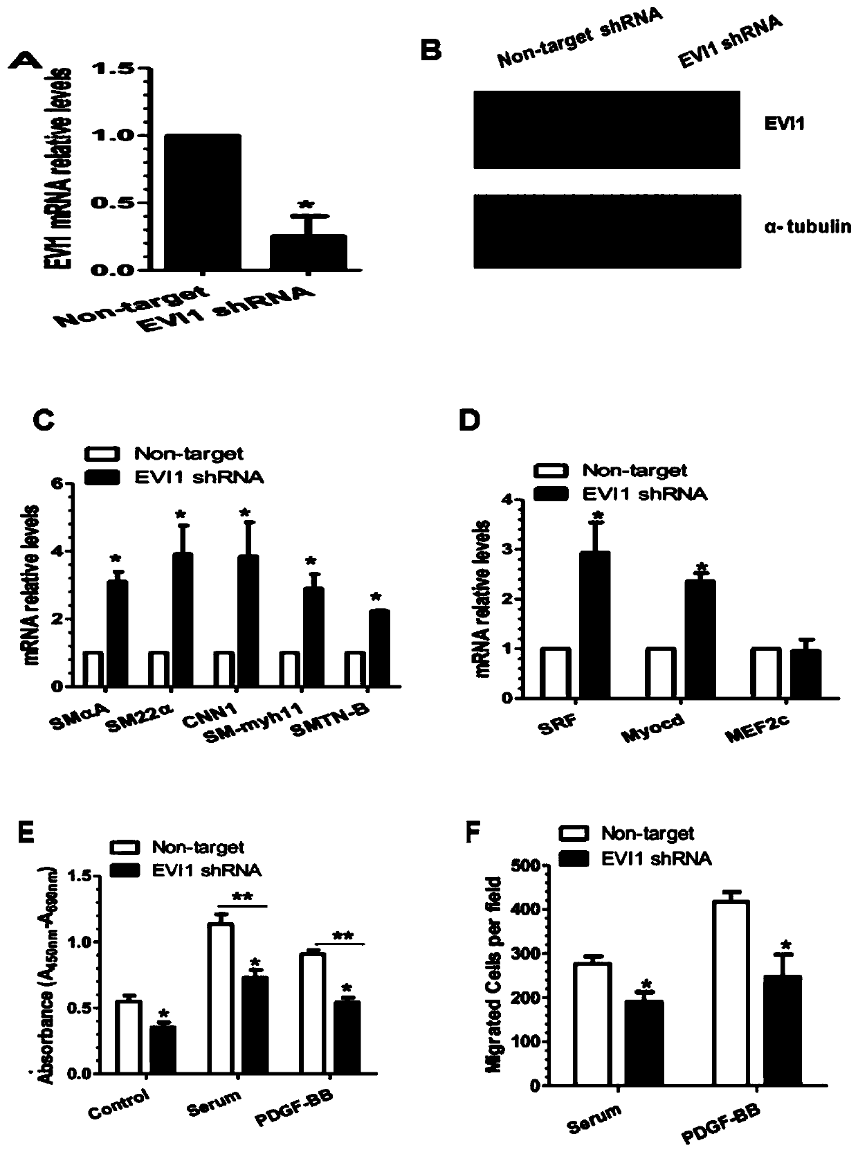 Application of evi-1 inhibitor in preparation of medicine for treating abnormal vascular remodeling disease