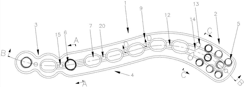 Distal clavicle locking plate