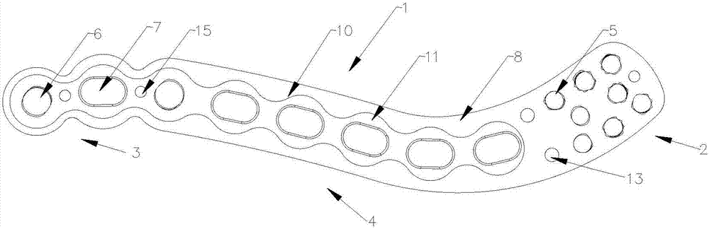 Distal clavicle locking plate