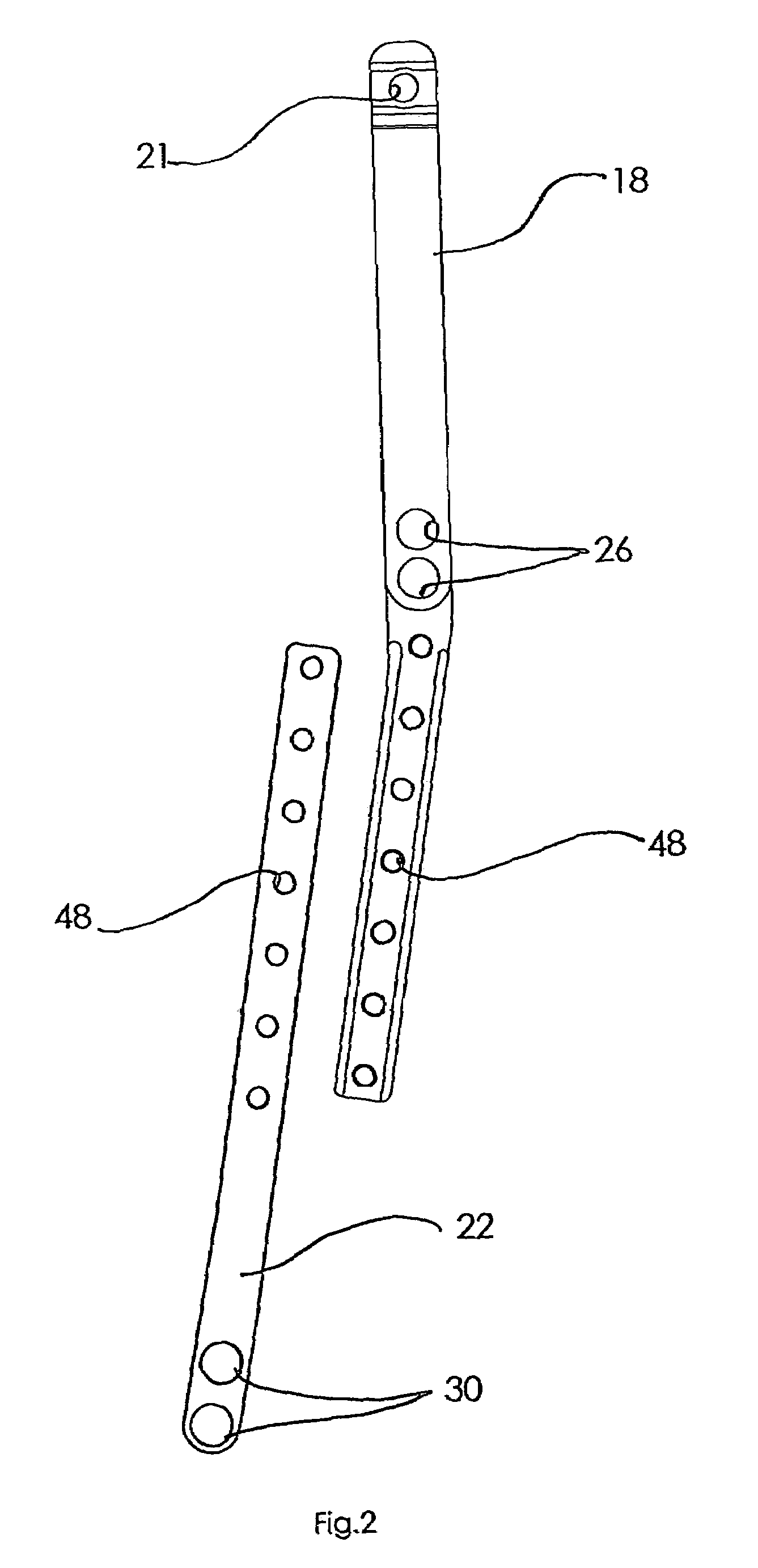 Method and apparatus for locating and stabilizing an orthopedic implant