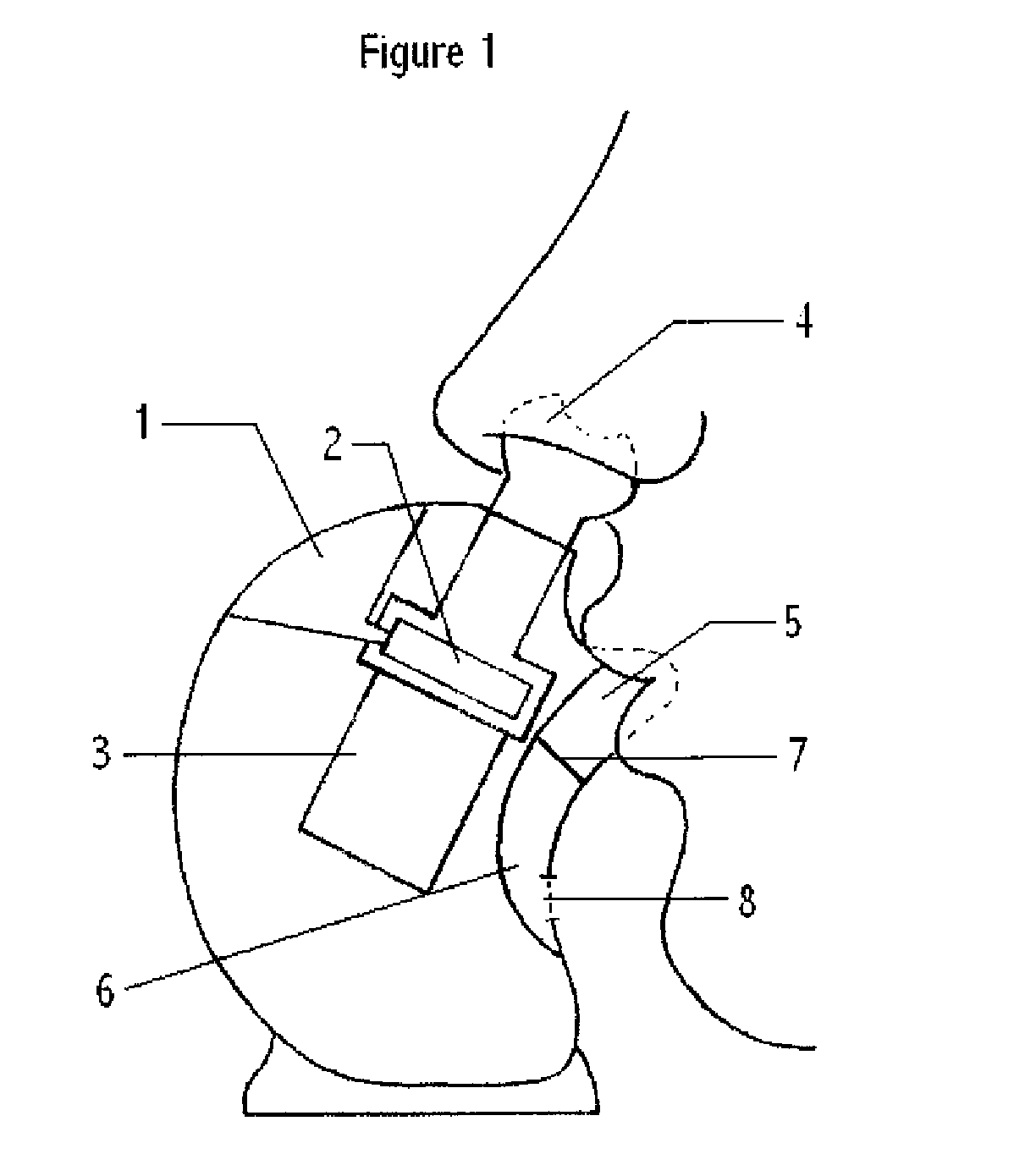 Aerosol therapy device with high frequency delivery