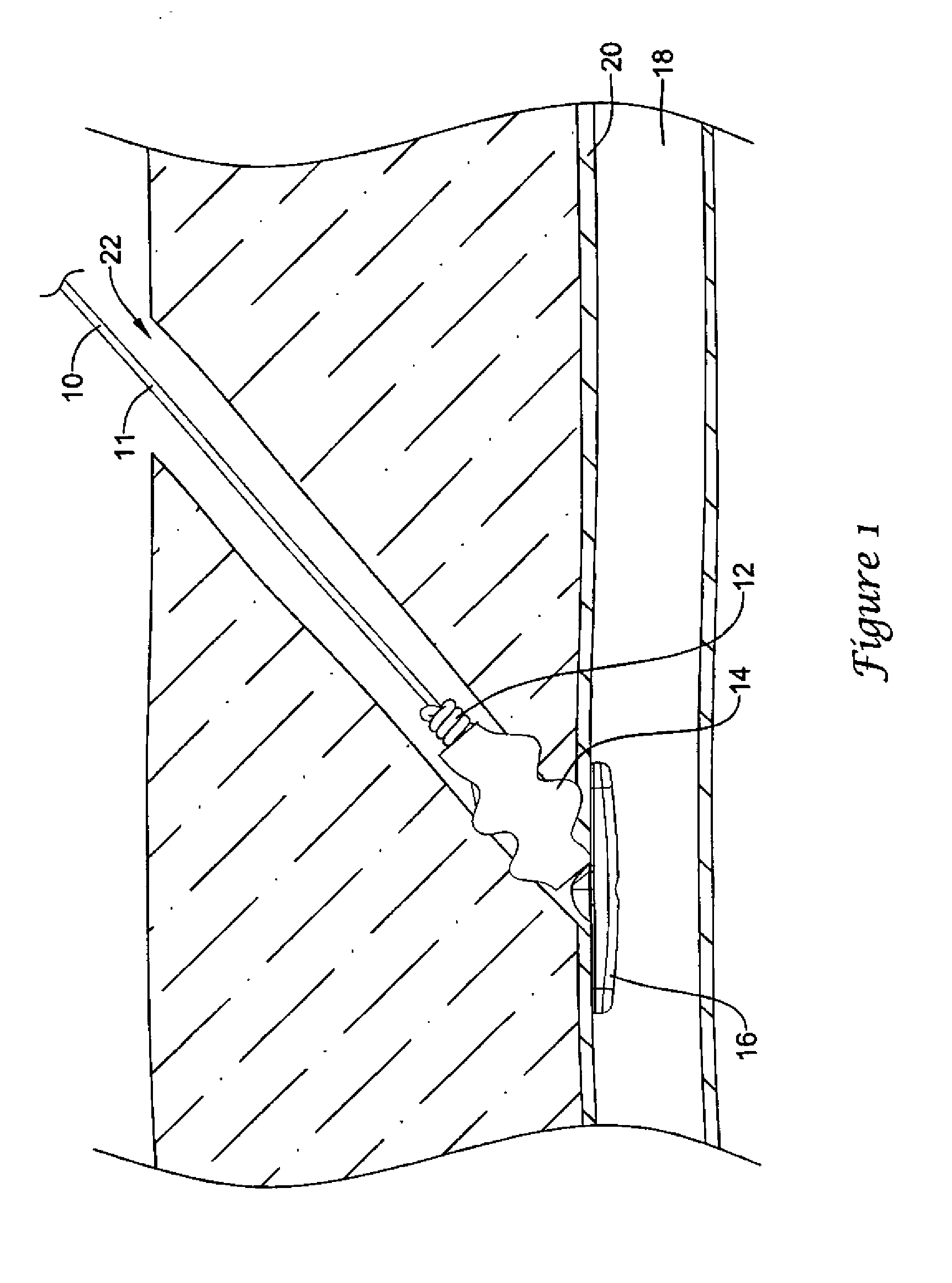 Device to detect internal bleeding