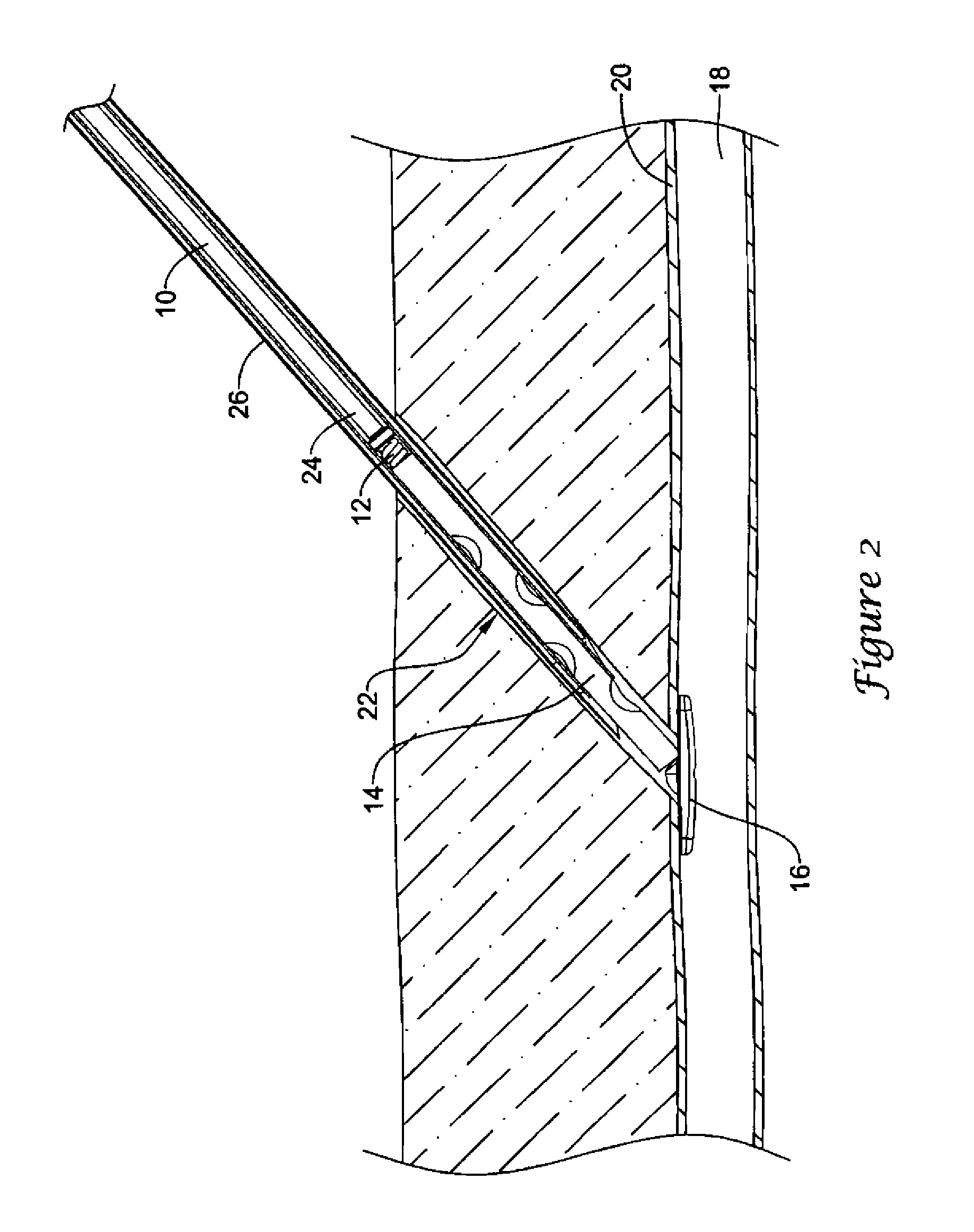 Device to detect internal bleeding