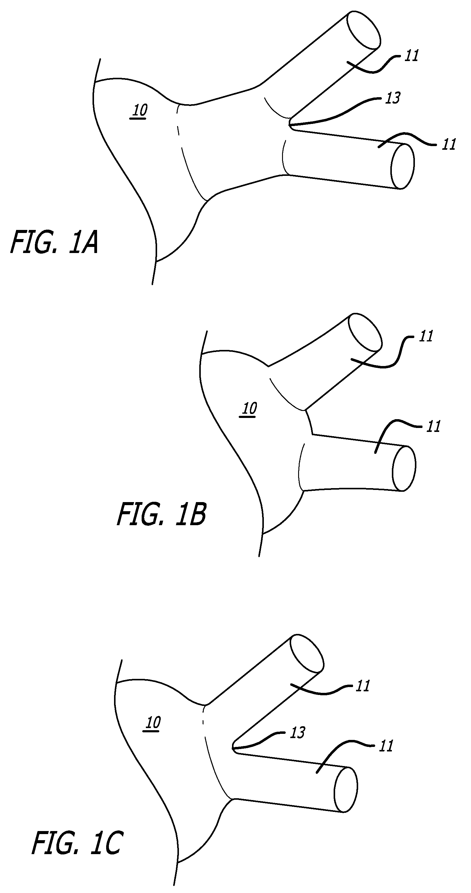 Electrical Conduction Block Implant Device