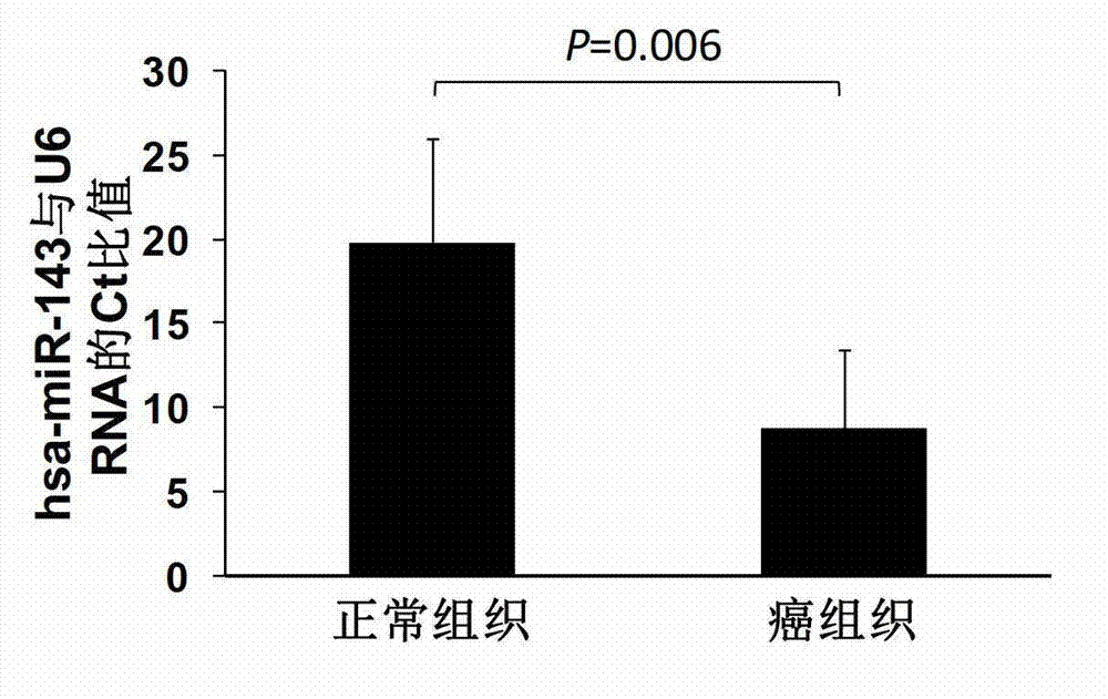 MicroRNA (micro ribonucleic acid) for regulating gene expression of B7-H3 (a molecule of the B7 family)