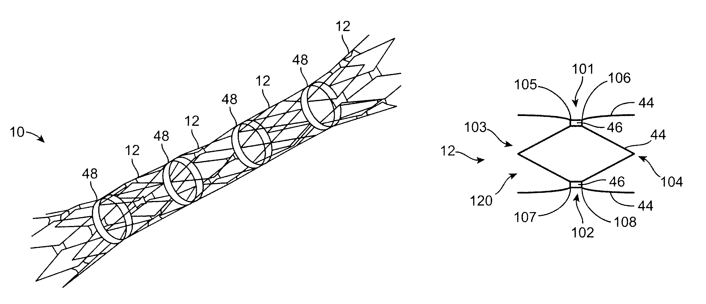 Flexible stent and method of making the same