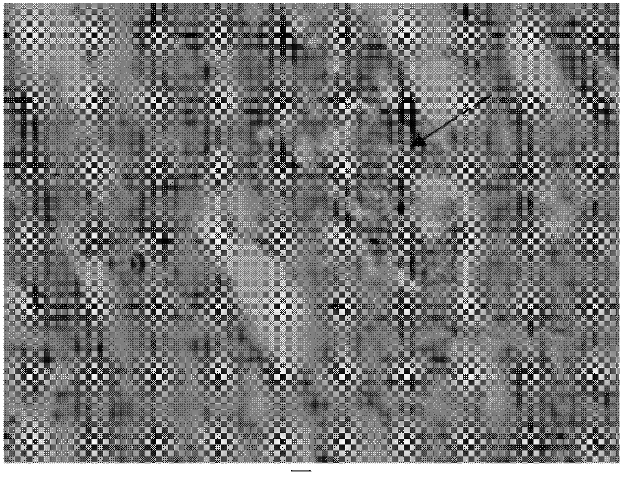 Oxalic acid degrading bacterium NJODL1 and application thereof